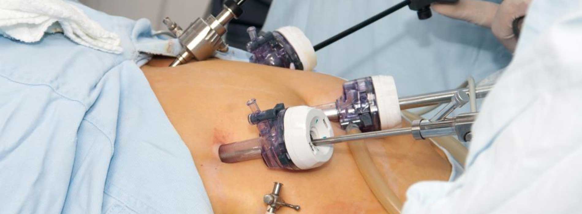 Gastrology Treatment in Kochi